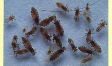 梦见虱子在头上