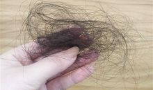 脱发适合发朋友圈的句子