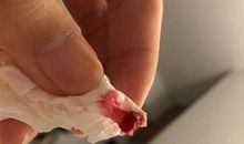 流鼻血的朋友圈说说 老是流鼻血的说说