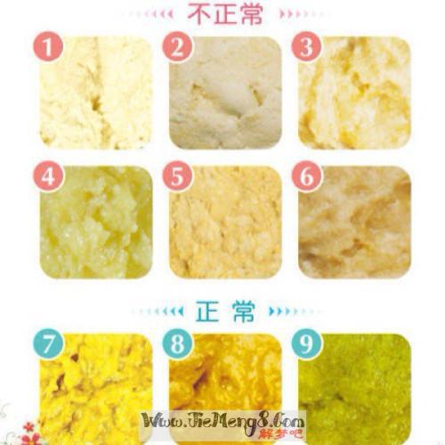   梦见孩子屎