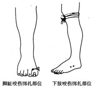   梦见被蛇咬