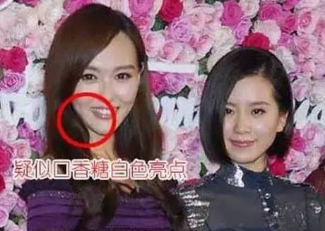 泡泡糖线