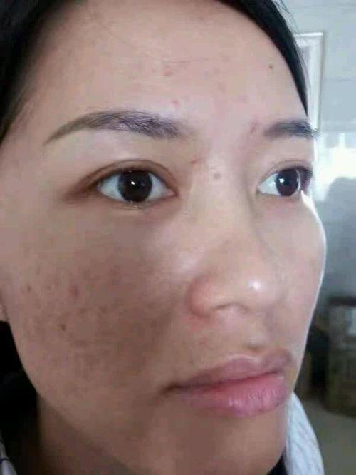 雀斑经典句子
