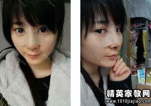 石雕眼寓言