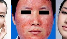 鼓励女人祛斑的句子