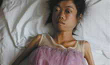 徐訏：谈美丽病