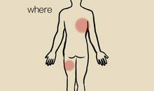 十八岁患癌女生:癌痛到底有多痛?