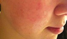 皮肤过敏的个性签名