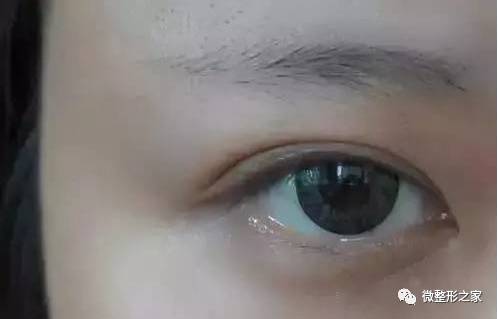 眉毛出汗，眉毛下流泪