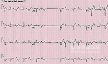 描写喜怒哀乐的段落