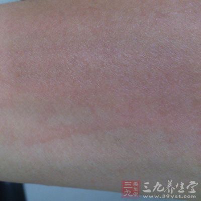 没有皮肤的身体