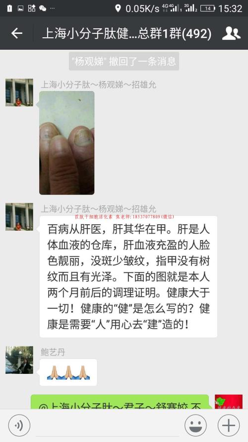 张磊：春日·冰糕冰糕