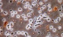 爱自己——《工作细胞》观后感