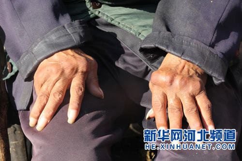 父亲的手