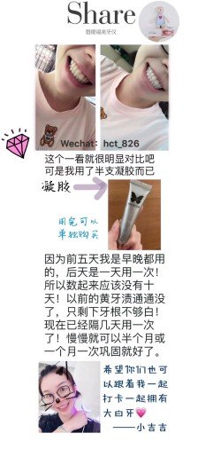 洁白的牙齿