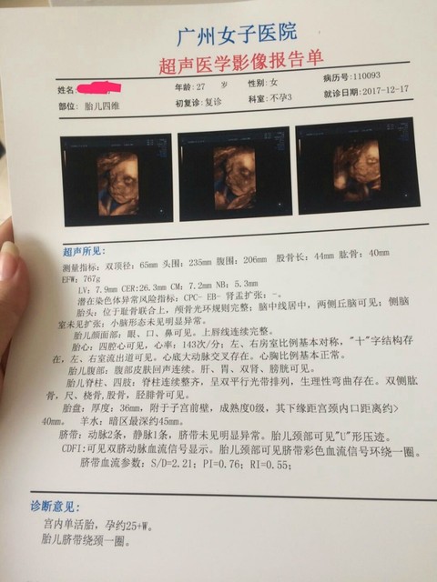 说话混乱