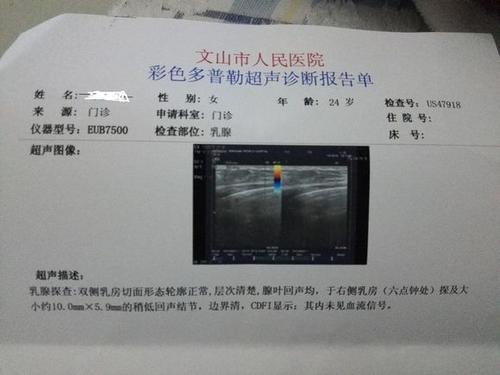 几点钟