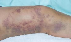 那些带着伤口的句子:每一个表达背后的痛苦和深层情感